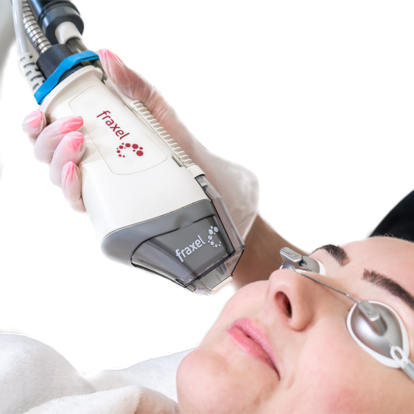 female patientrecieving a Fraxel Laser treatment